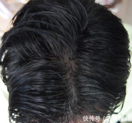 『百科』农家百科:怎么自制黑色染发配方