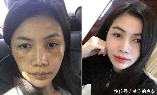 皮肤需要胶原蛋白