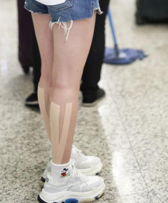 唐艺昕变胖了,穿短裤大腿显粗,然而看见她小腿的绷带我懵圈了!