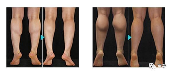 杨紫和关晓彤体重相同却被吊打，只因这个部位粗显胖20斤！