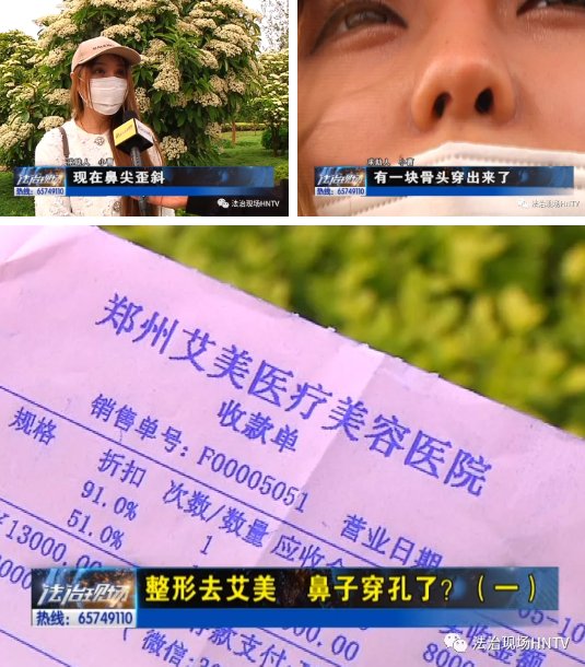  『院方提供』整形去艾美 鼻子穿孔了？