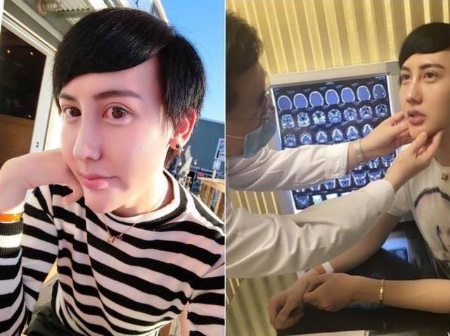 为了证明自己没有整容，有人开直播解释，有人晒出了亲妈的照片！