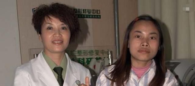 她竟然也整容了,整容后惊呆众人