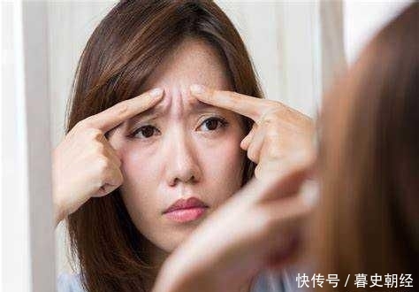 『皮肤』小细纹和表情纹有什么不同?皱纹的分类和形成原因