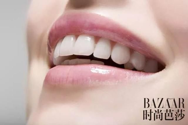 吴宣仪“牙龈笑”好甜！关于美牙你还得知道这些！