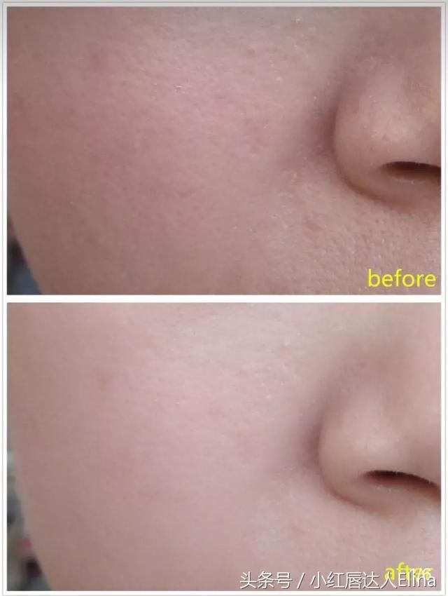 张雪迎、秀智素颜曝光？中韩国民初恋谁的颜值最抗打？