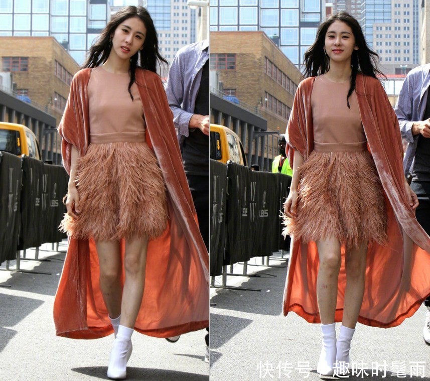 路遇张碧晨,在无美颜的镜头下这腿吓到我了,网友:穿上裤子吧!