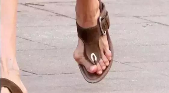 看完穿高更鞋的脚，你还敢那么爱高跟鞋吗？