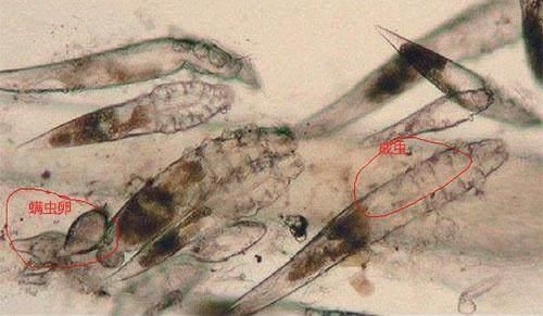 脸上螨虫爆发时有4信号,不除螨,再多护肤品都是在喂养螨虫