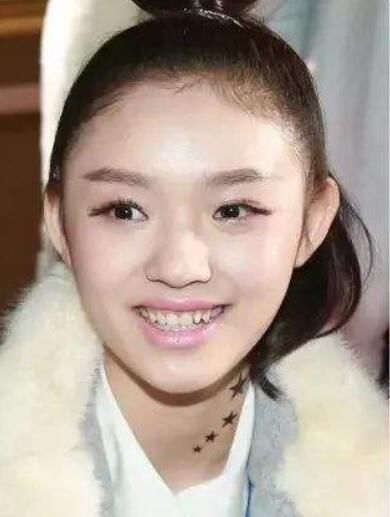 丁香医生拆台高晓松：拔牙不会让脸变小，那杨颖杨幂是怎么回事？