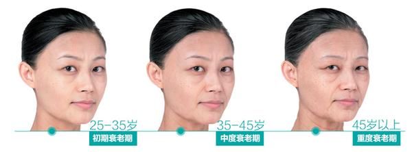 一众90后小花显初老症状,保养要从年轻时候开始!