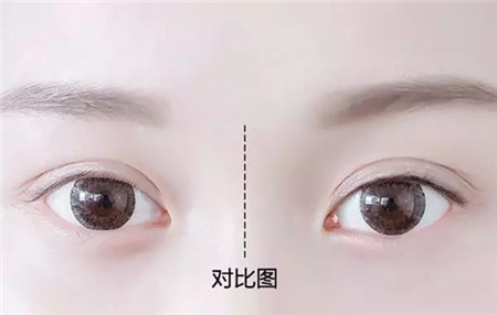 教程■眼线画什么?怎么画?堪比整容的眼线教程来了