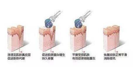  「脸上」一个女孩最干净的样子，就是脸上无“斑”