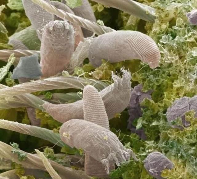 起床后这5个表象，毛孔已被螨虫侵占！坚持3招除尽