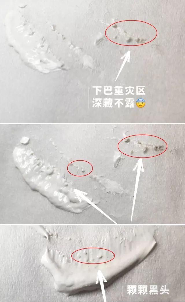 拔出黑头粉刺,地毯式清洁肌肤,还能缩小毛孔!素颜也自带妆容