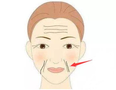 女人脸上最显老的4道皱纹,长全就变老奶奶了,学下面女人这样做