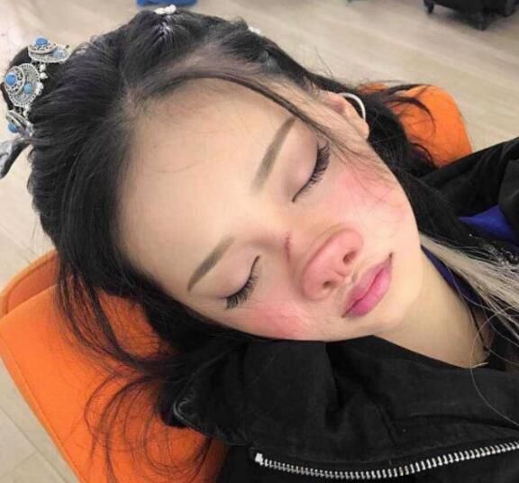 《流星花园》藤堂静长“猪鼻子”，近照嘴巴难看，像50岁的老太