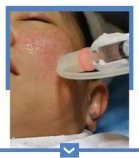 【行业内幕】冒死曝光水光针的低价套路，你一定曾经中过招!