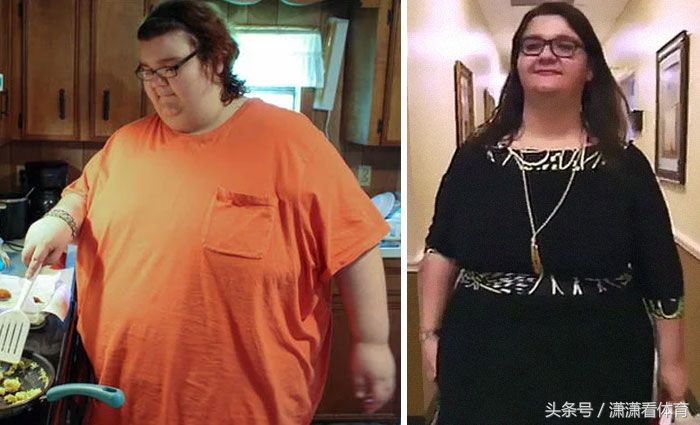 这群体重超过500斤的人仍回归正常，减肥堪比整容!