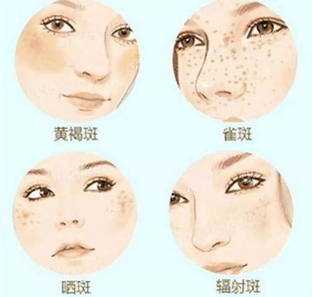  「脸上」一个女孩最干净的样子，就是脸上无“斑”