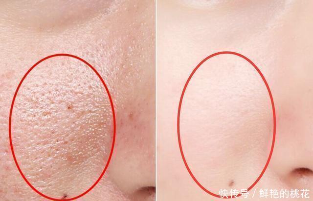  『欧莱雅集团』兰蔻圣罗兰等产品不合格被拒入境，业绩高手欧莱雅再陷“质检门”