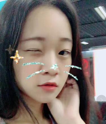 【美吧美啦案例】这逆天的颜值颠覆，竟只因一个双眼皮？！