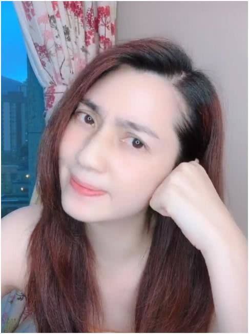 「泛红」49岁著名女星晒素颜照,露头皮疑似脱发,胳膊上泛红伤痕引担忧