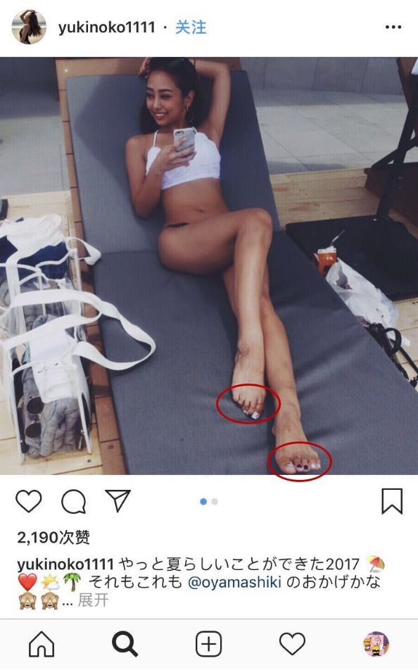 九头身靠p?连女明星都逃不过的“胯宽”问题有办法了!