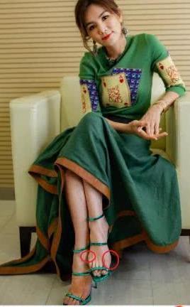 Ella为增高豁出去了，脚活生生被挤到畸形，网友：心疼她的小脚趾