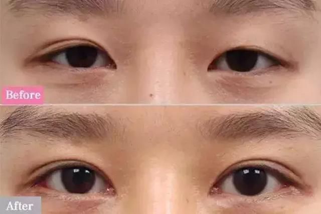 抖音眼:同样是眼睛,拯救全脸和祸害颜值的眼睛区别还真大