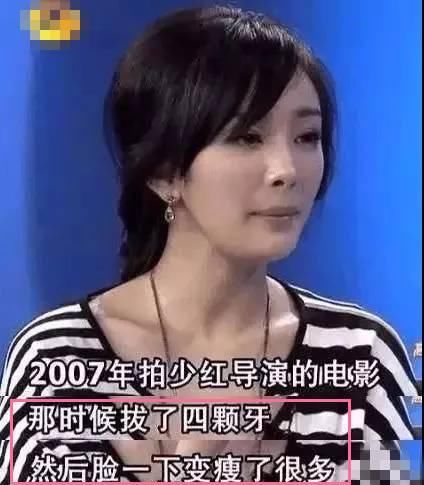 “整牙到底能不能瘦脸”终于有了权威结论，杨幂竟是被冤枉的?