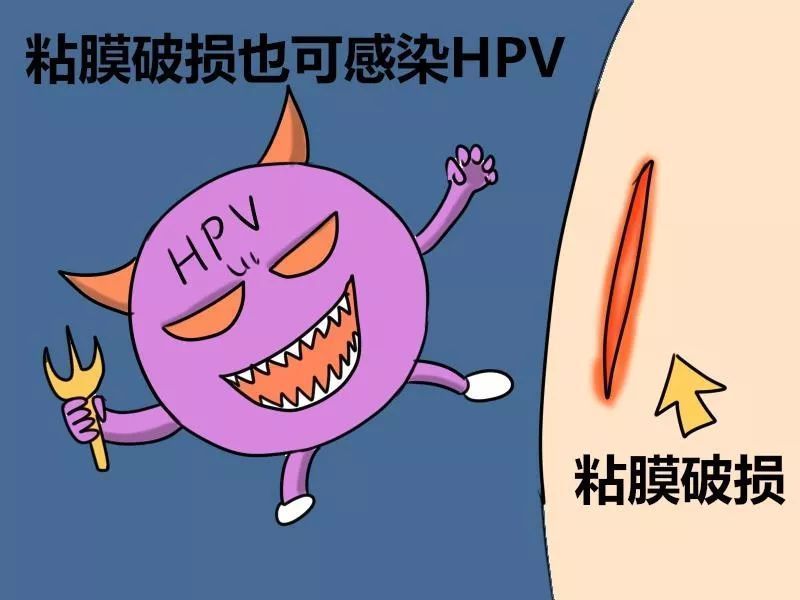 hpv檢測報告你讀懂了嗎?