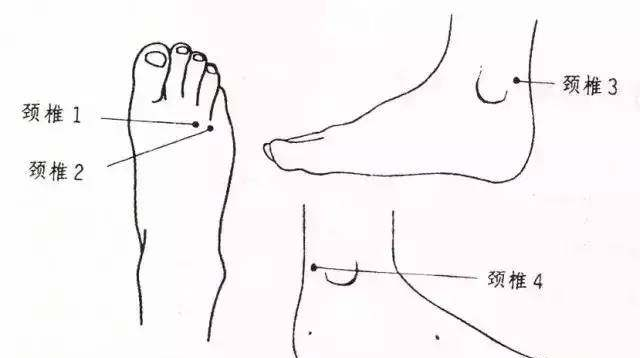颈椎病,别光按摩脖子了,按这个部位效果更好