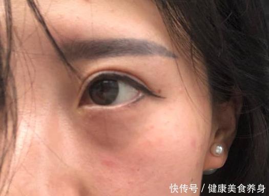 「吸收功能」越不会护肤的人,越喜欢用面膜,皮肤越差!