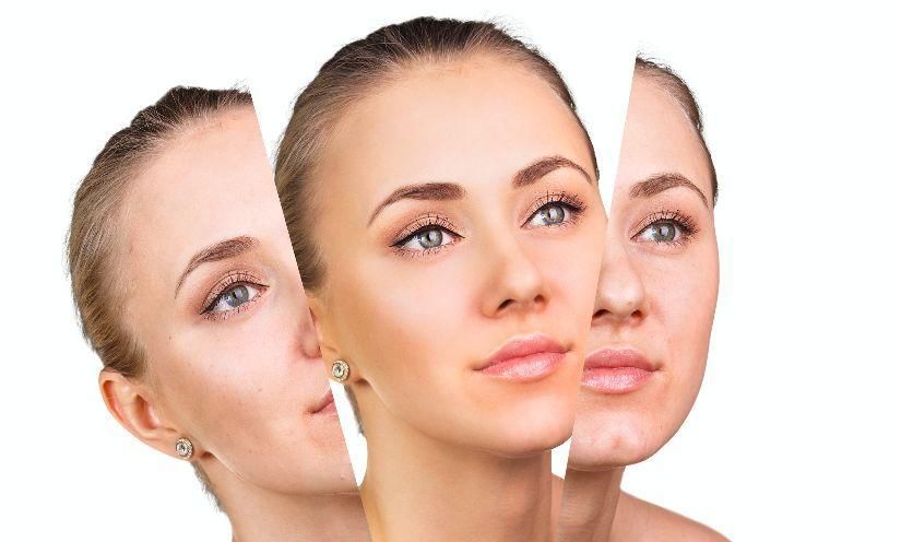 防晒后多做一件事,皮肤好了一大半