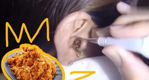 『分泌物』有些人的耳屎比较湿,而有些人的却比较干,你知道原因吗?
