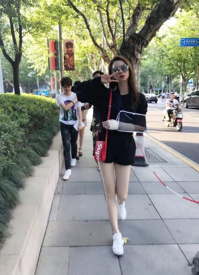 戚薇短裤穿的这么短，还要在腿根深处割2刀，安全裤都露出来了!