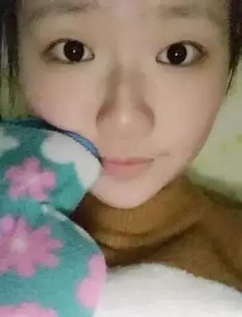 双眼皮+开眼角=我魅力大眼！