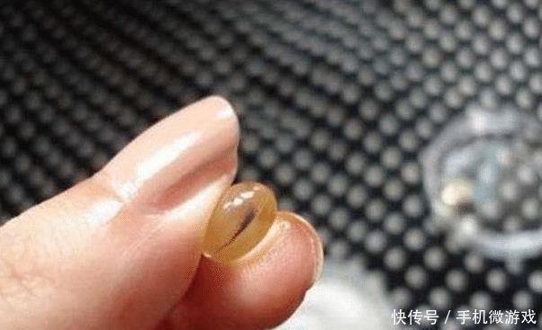  闺蜜■女人有皱纹别打玻尿酸，药店药膏”搽一搽，皱纹消失