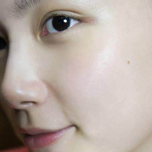 意外长痘除不掉?螨虫作祟,每天洗脸用“它”抹一抹祛除痘痘