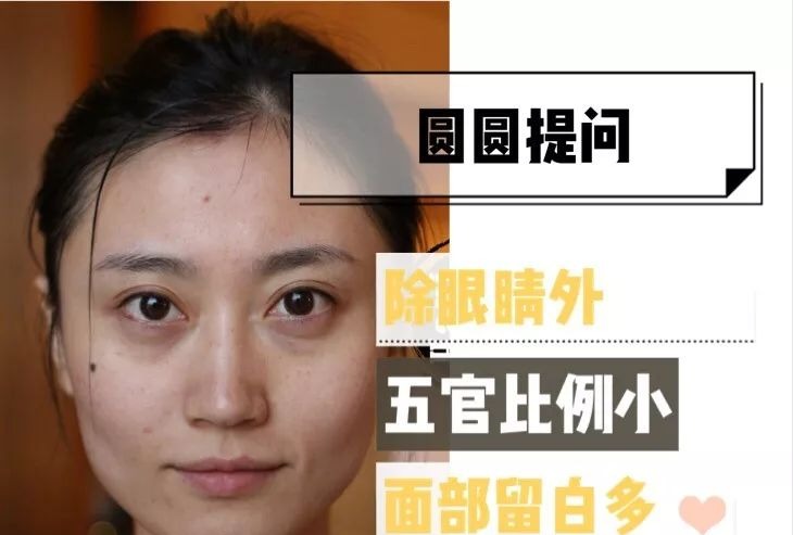  「衰老问题」素人整形分析 | 做对这些，宽方脸比瓜子脸更有优势