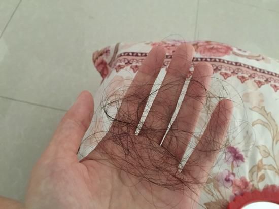 天气开始热了,躲在头上螨虫开始出来觅食啦,