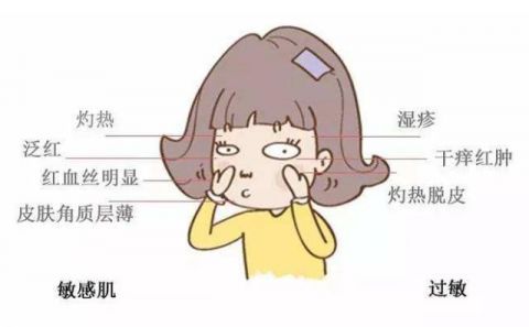  【中招】关于过敏丨每三个女生中就有一个可能是敏感肌，你中招了吗？