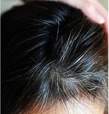 别再傻傻去染发店了!洗头时倒一点进去，满头白发瞬间乌黑靓丽