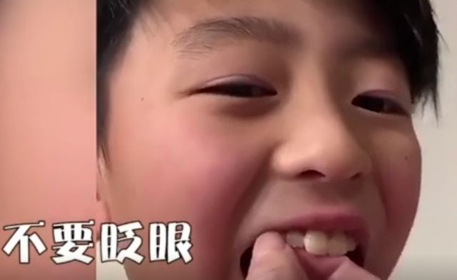 张柏芝给拔牙视频