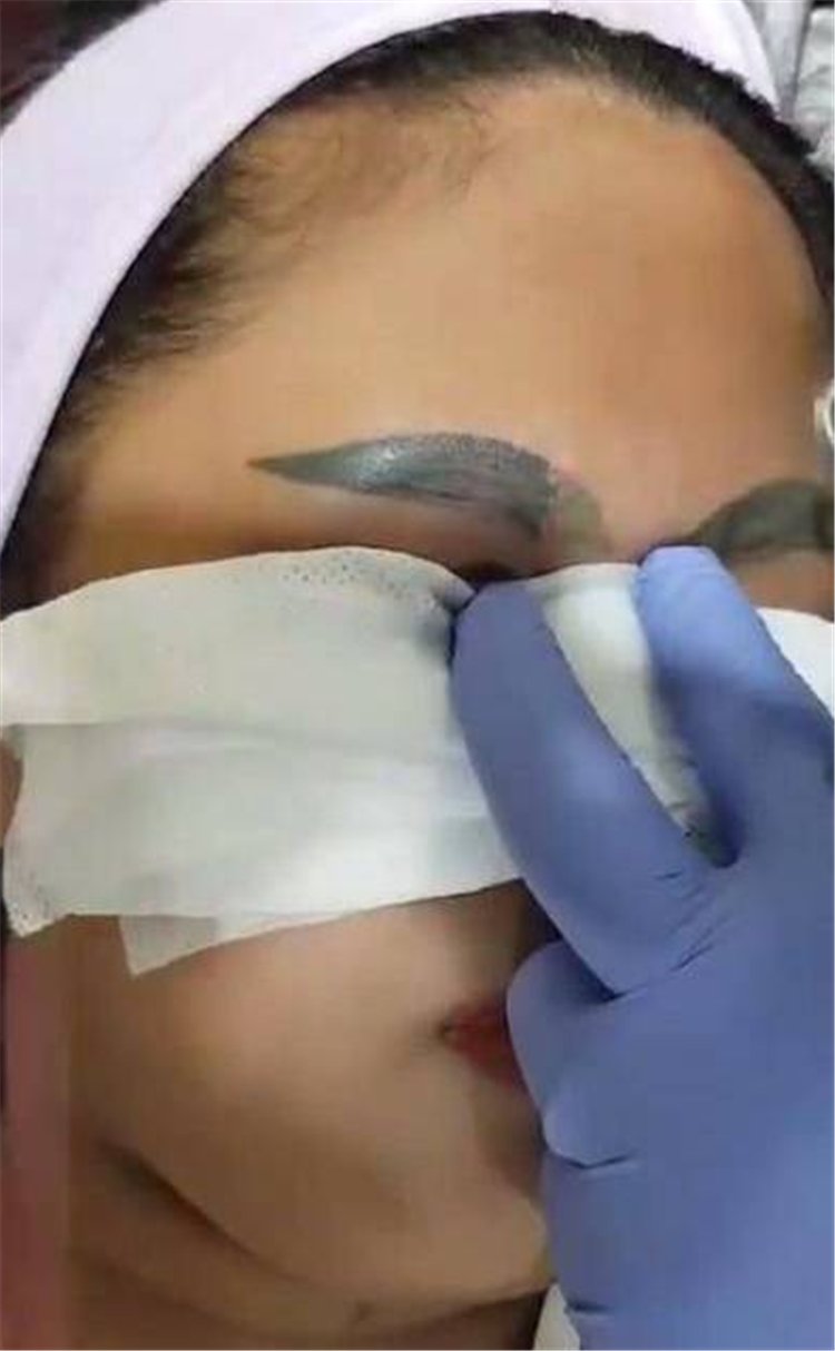 26岁女子做纹眉手术结果变成“关公”，让她哭笑不得