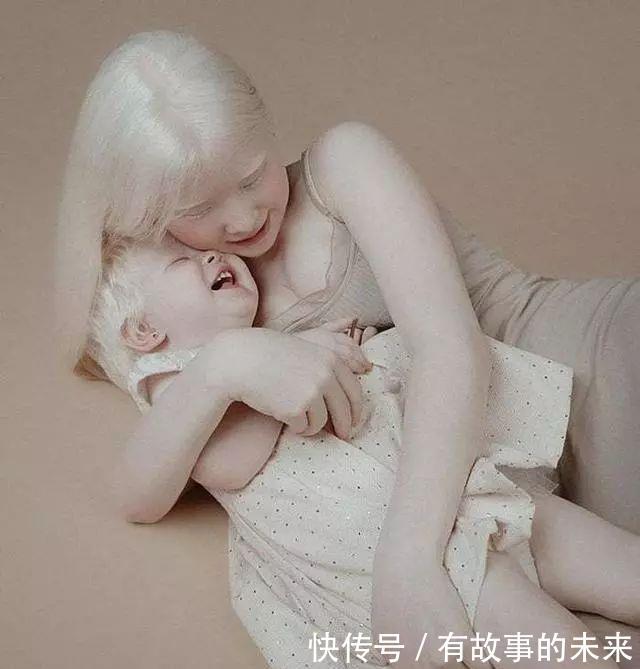 『冷嘲热讽』最“励志”姐妹花,从小饱受冷嘲热讽,如今逆袭成国际超模