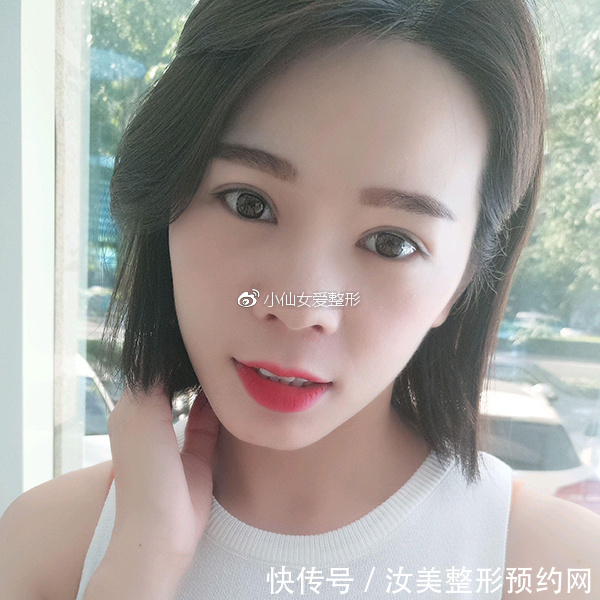 开内眼角前后对比照片，不灵不灵的大眼睛也着实的迷人