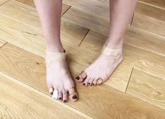 穿高跟鞋有多辛苦?冉莹颖脚被勒出印，她的脚趾变形