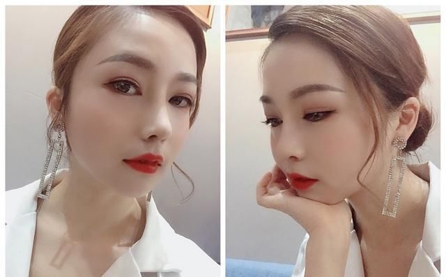  #术后#隆鼻真的有用吗？鼻综合术后六个月记录，这完全不是一个人！